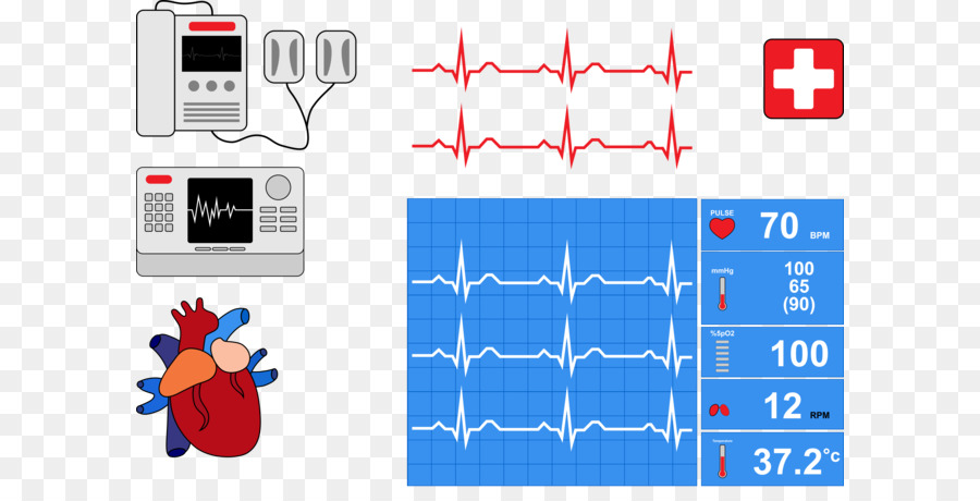 Monitor De Corazón，Ecg PNG