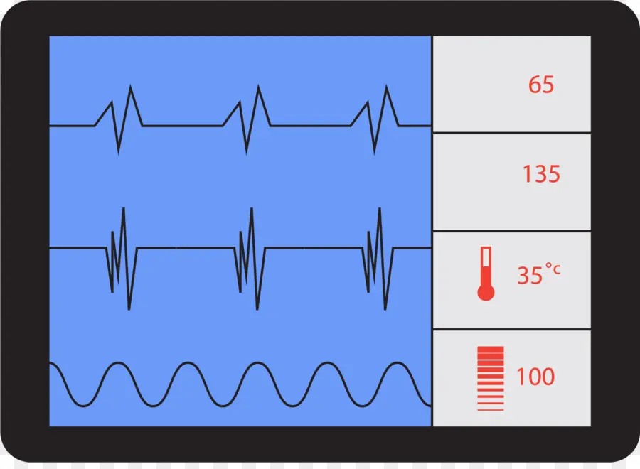 Electrocardiografía，La Frecuencia Cardíaca PNG