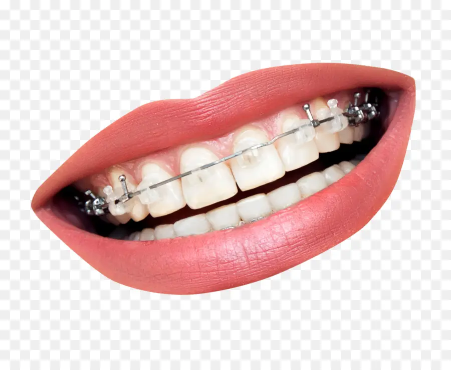 Tirantes，Dientes PNG