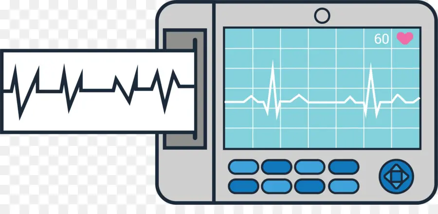 Electrocardiografía，Monitoreo PNG