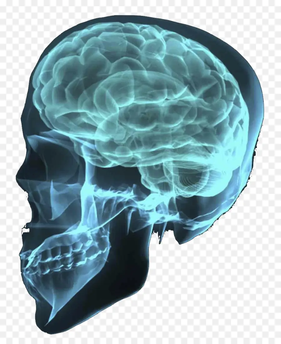 Cerebro，La Lesión Cerebral Traumática PNG