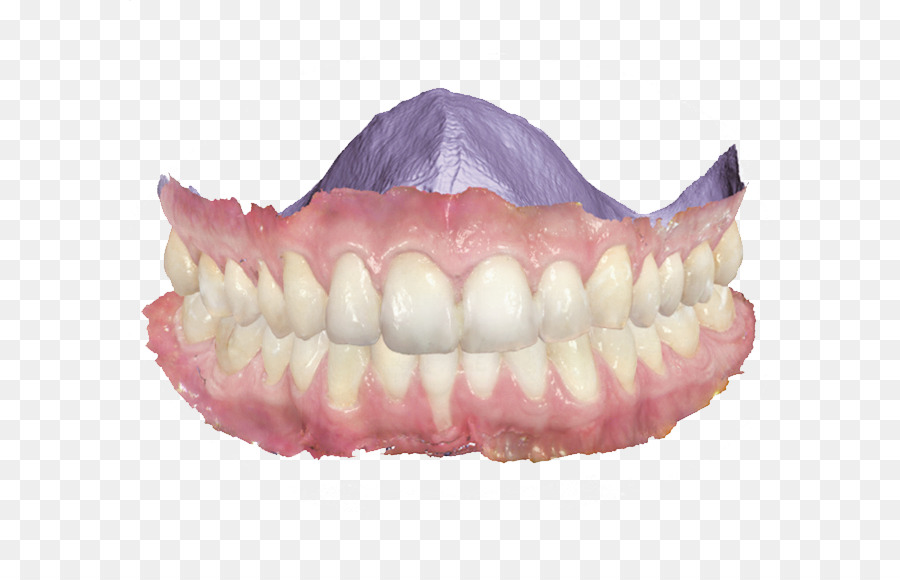 Modelo De Dientes，Dental PNG