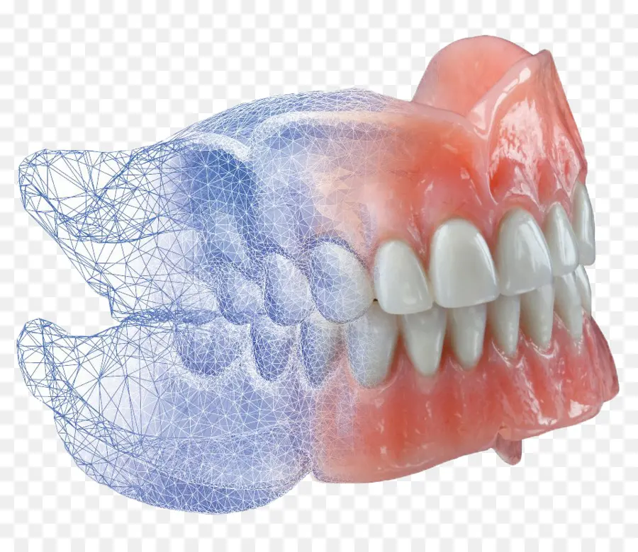 Avadent，Las Dentaduras Postizas PNG