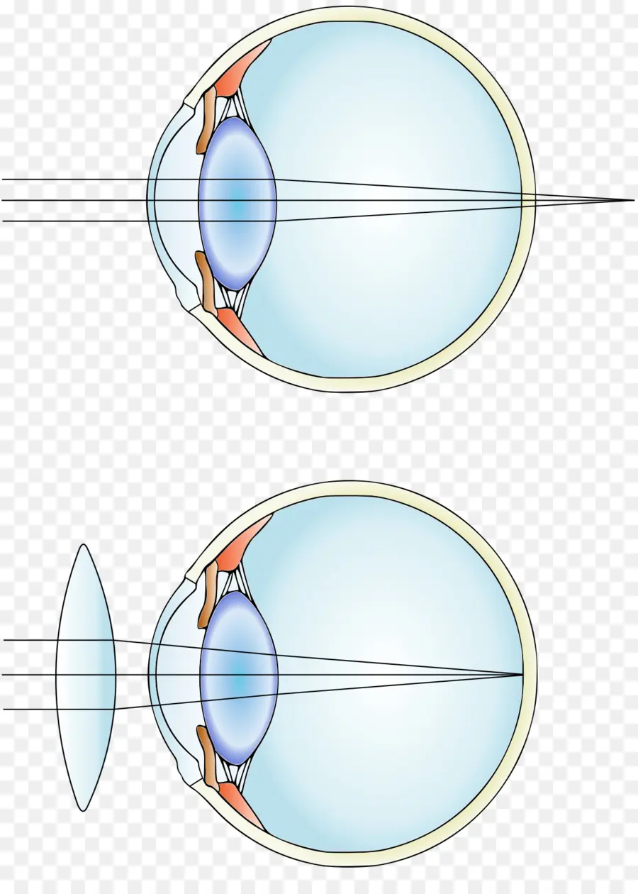 Diagrama Del Ojo，Lente PNG