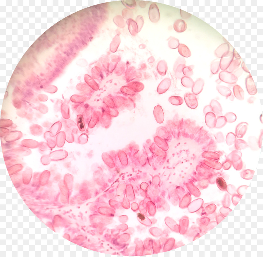 Protista，Cyclospora Cayetanensis PNG