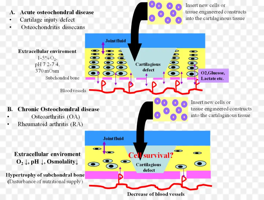 Diagrama De Enfermedad Osteocondral，Cartílago PNG