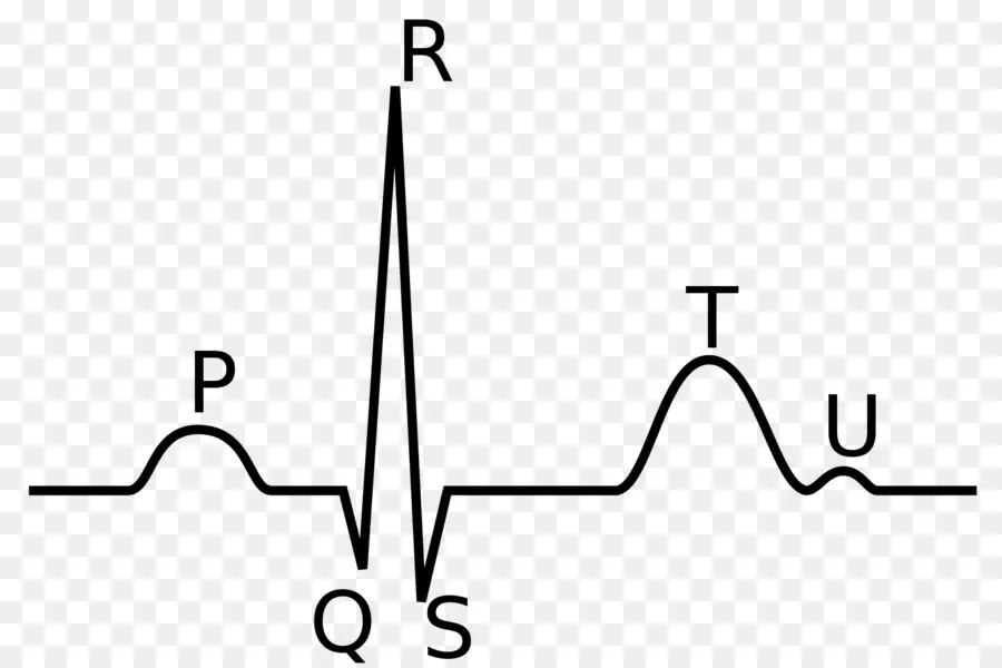 Complejo Qrs，Electrocardiografía PNG