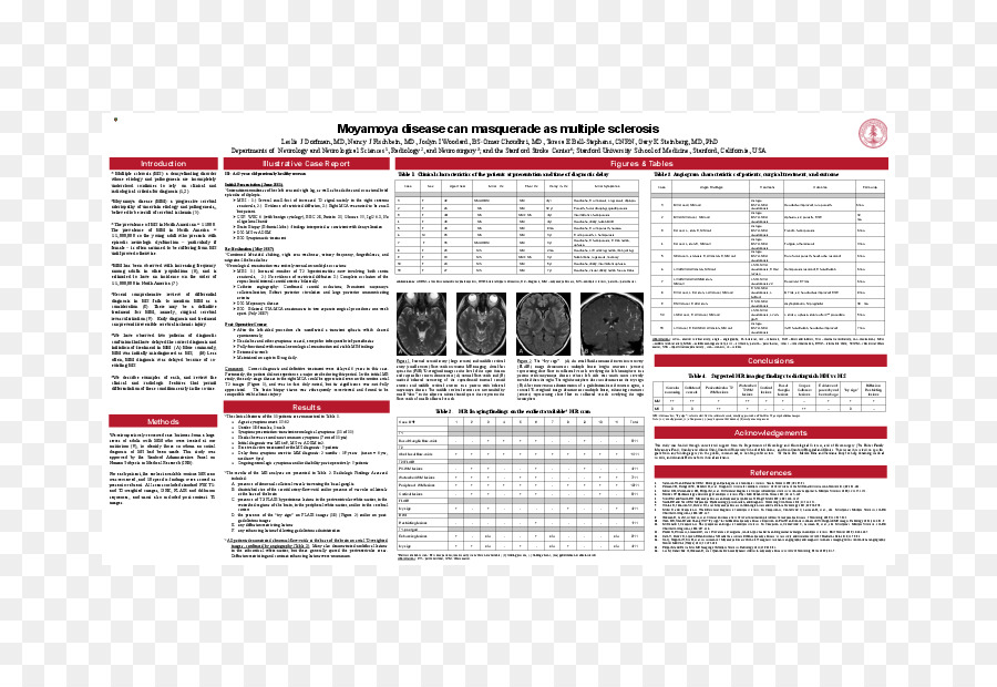 La Esclerosis Múltiple，Enfermedad De Moyamoya PNG