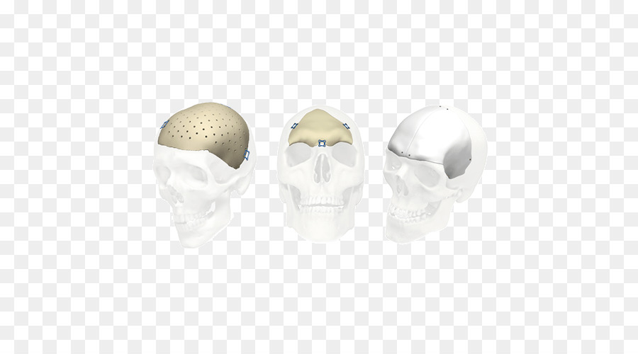 Cráneo，Stryker Corporation PNG
