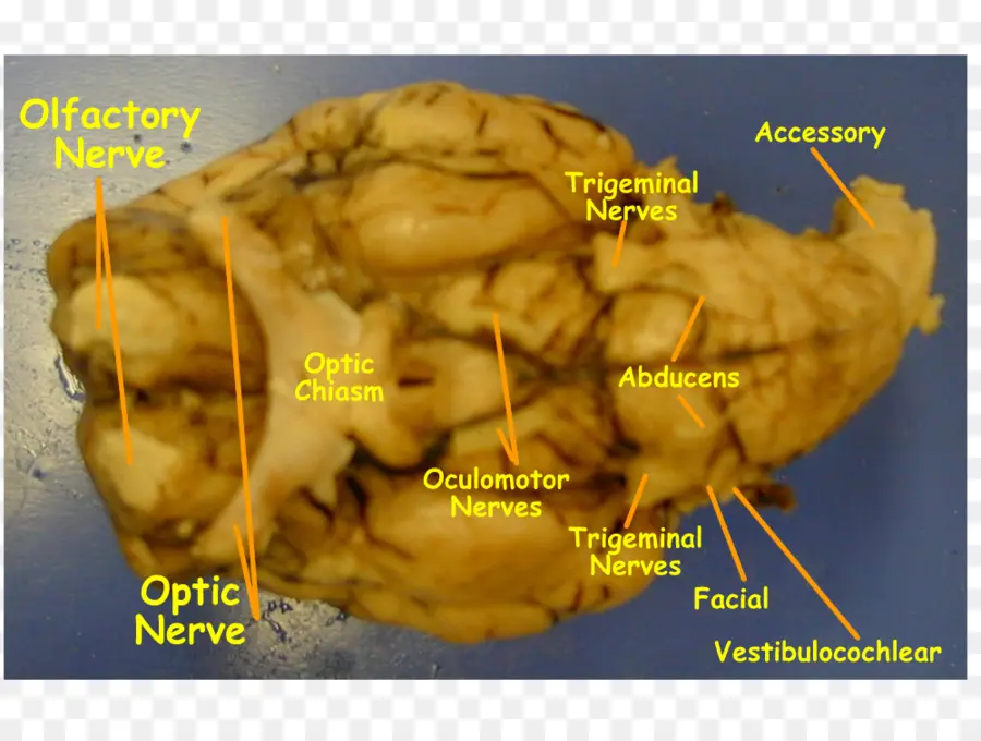 Cerebro，Nervios PNG