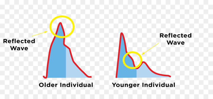 Velocidad De Onda De Pulso，De La Onda De Pulso PNG