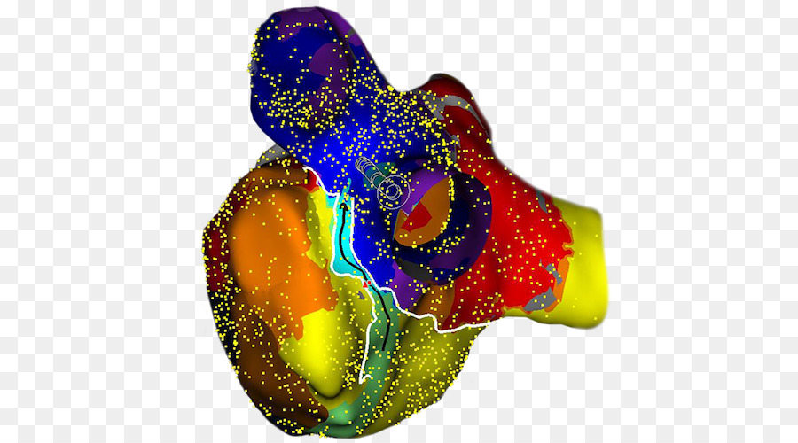 St Jude Medical，Cardiología PNG