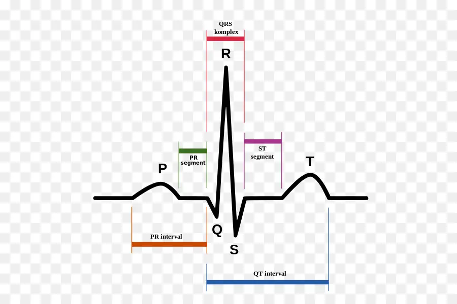 Ritmo Sinusal，Electrocardiografía PNG