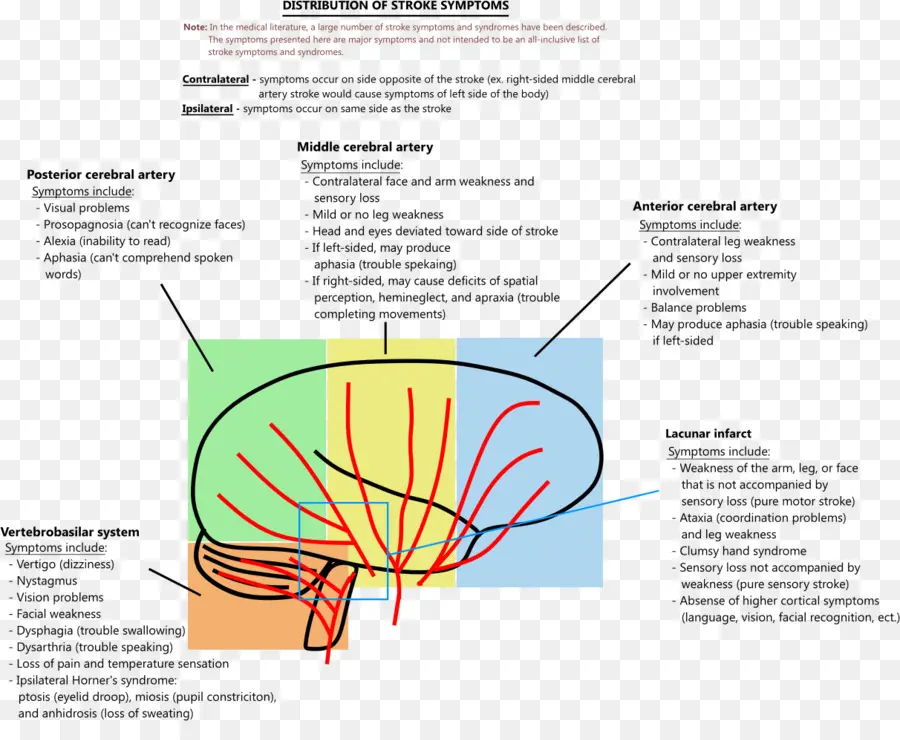 Diagrama Del Cerebro，Ataque PNG