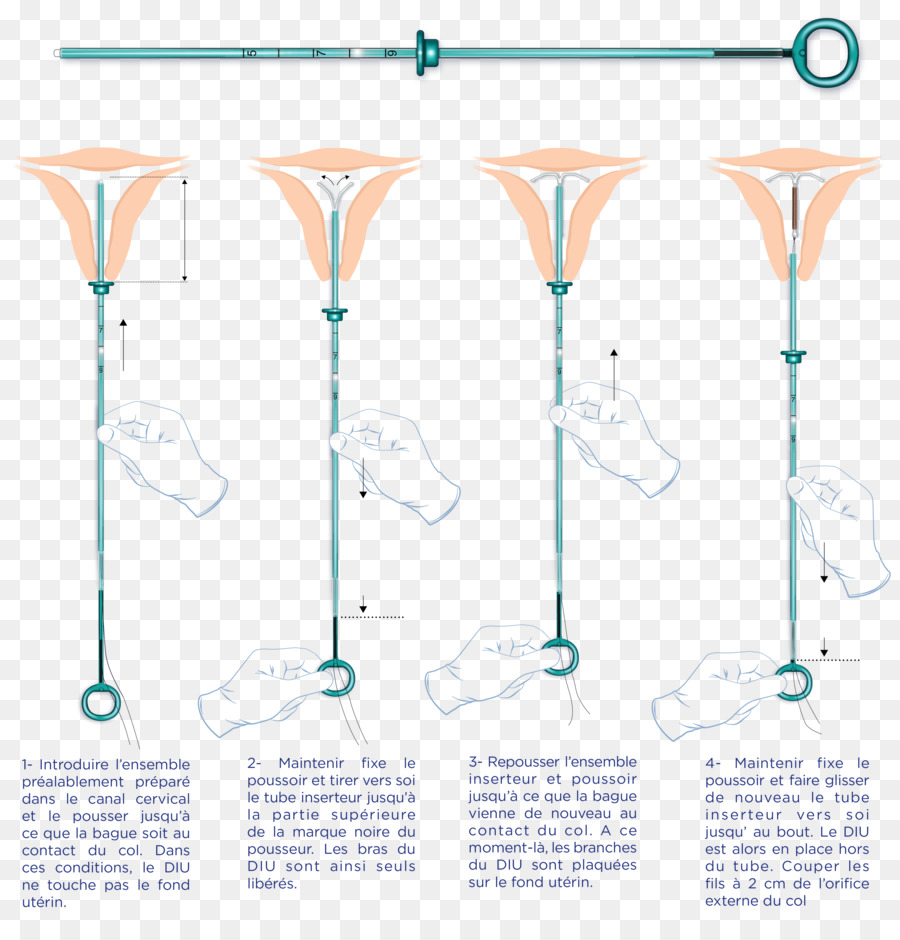 Instrumento Medico，Procedimiento PNG