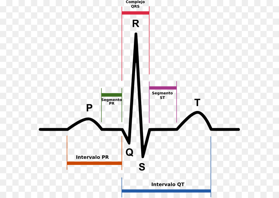 Electrocardiografía，Complejo Qrs PNG