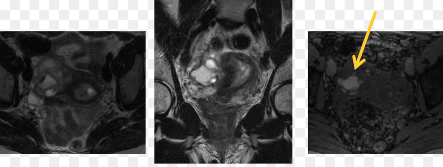 Radiología，Imágenes Médicas PNG