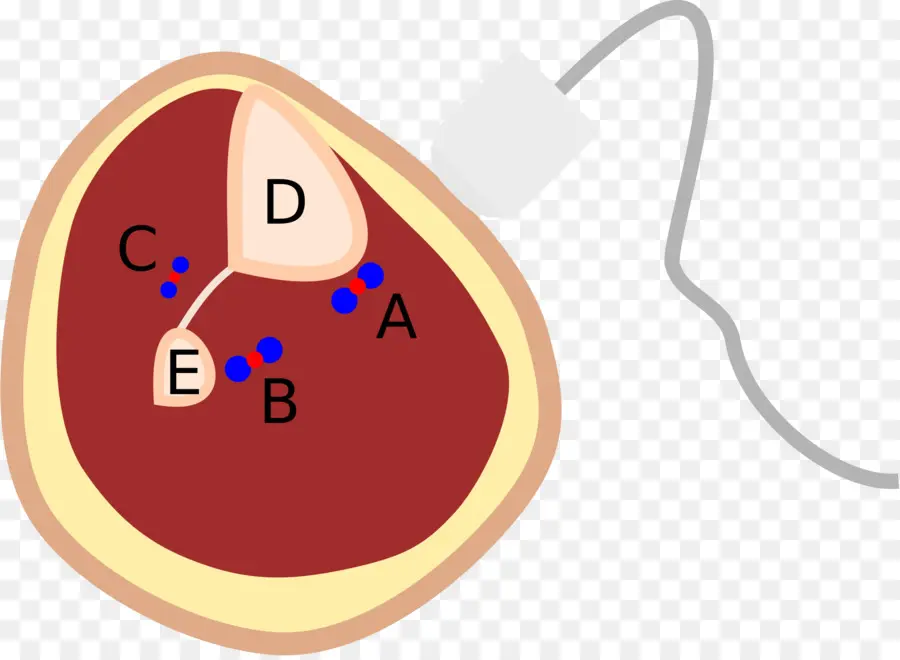 Becerro，Arteria Tibial Posterior PNG