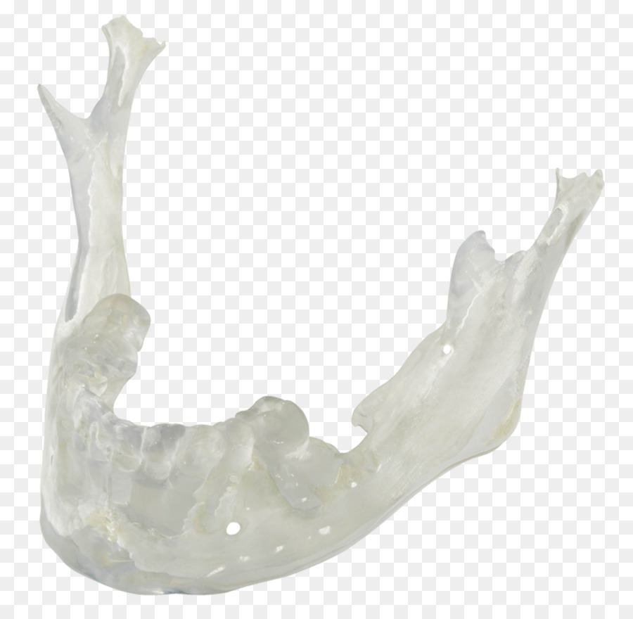 Dental Artesanos Inc，La Impresión En 3d PNG