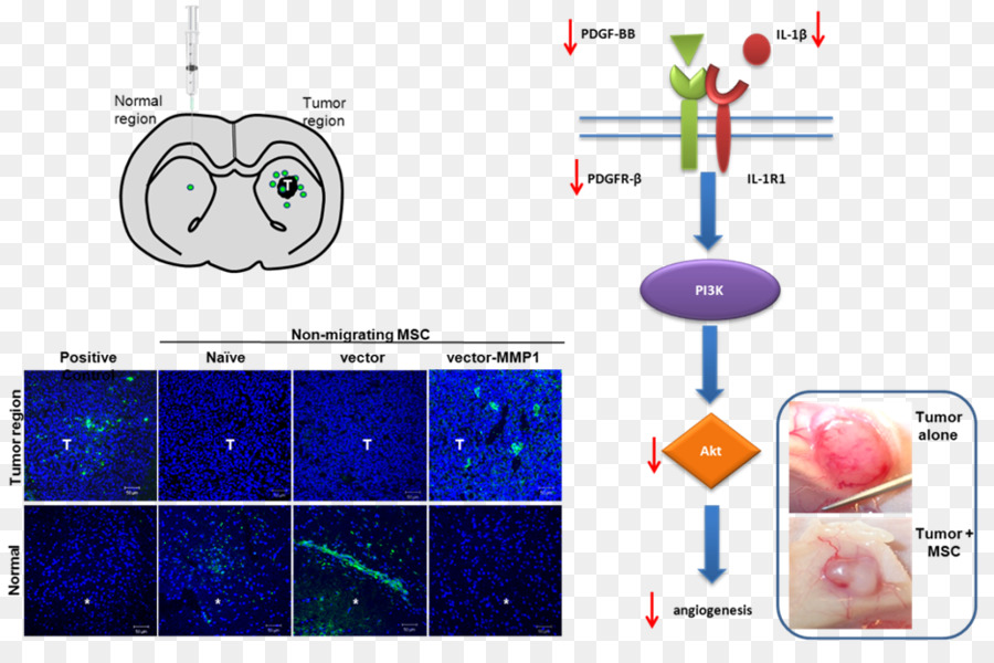 El Cáncer，Virus Del Herpes Simple PNG