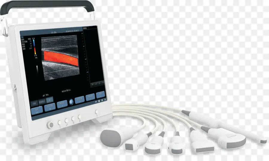 Ultrasonografía，Ecocardiografía De Doppler PNG