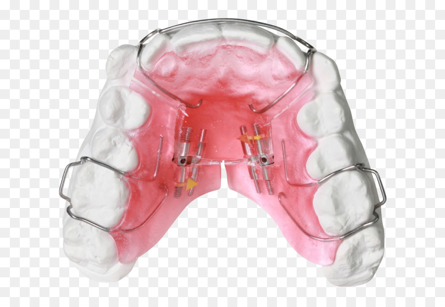 Retenedor Dental，Dientes PNG