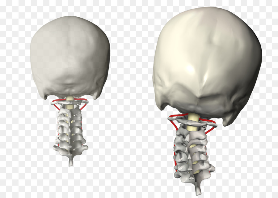 La Subluxación Vertebral，Subluxación PNG