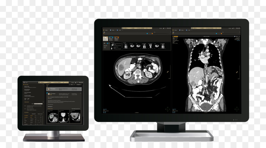 Picture Archiving And Communication System，Philips PNG