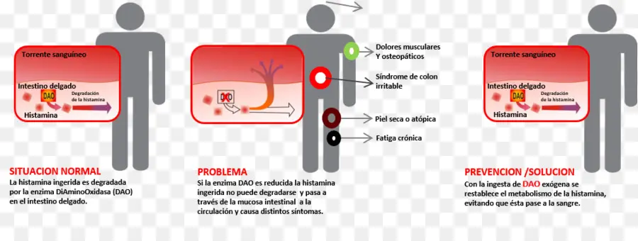 Diamina Oxidasa，La Histamina PNG