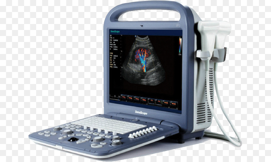 La Ecocardiografía Doppler，Ultrasonido PNG