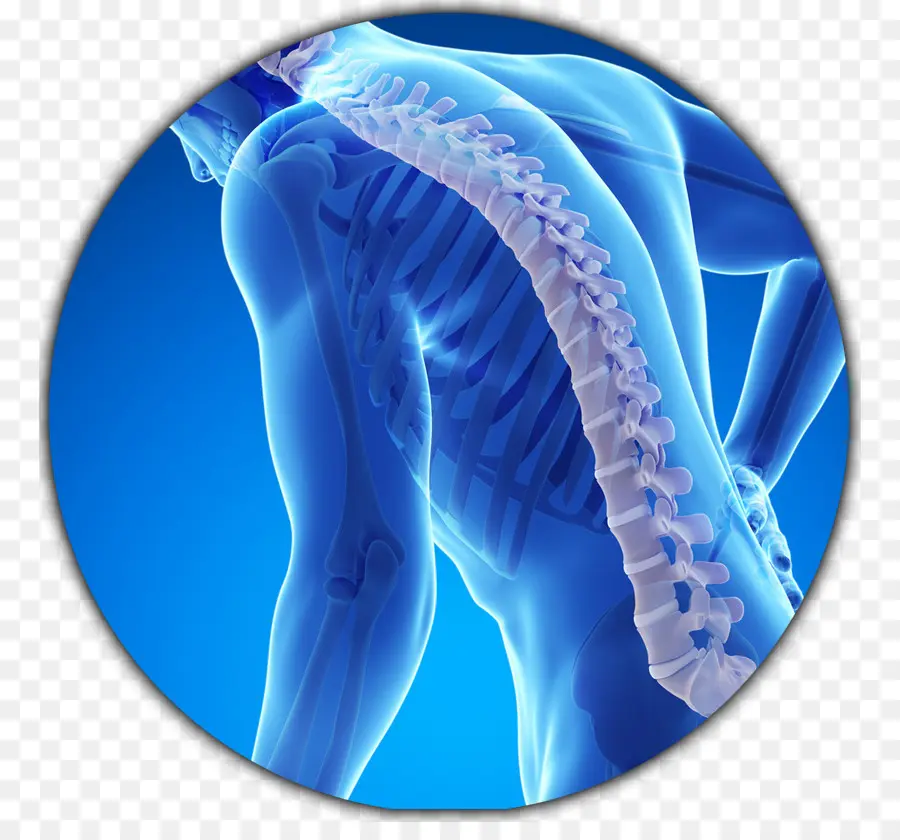 La Osteoporosis，Fractura De Hueso PNG