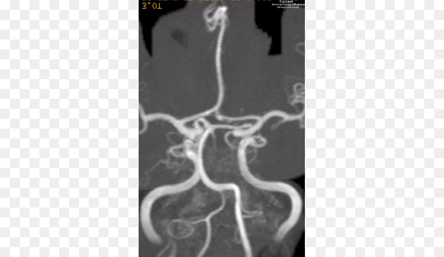 Imágenes Médicas，Radiología PNG