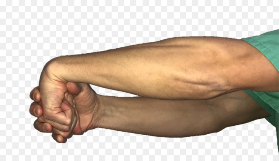 Pulgar，El Codo De Tenista PNG