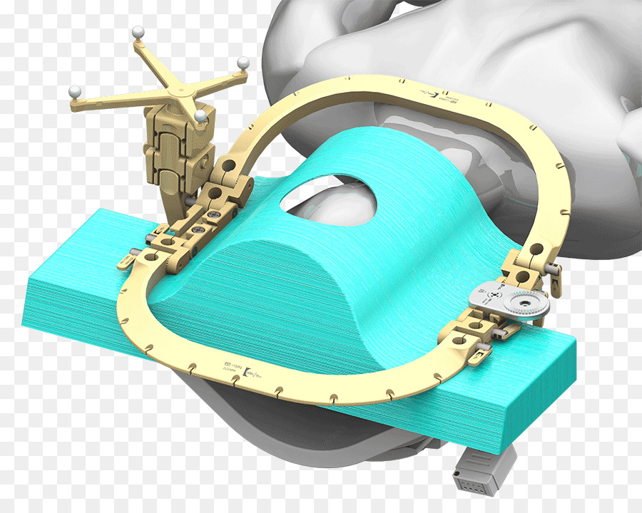 Neurocirugía，Imágenes De Resonancia Magnética PNG