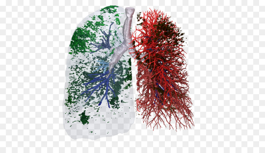 Sociedad Respiratoria Europea，La Fibrosis Pulmonar Idiopática PNG