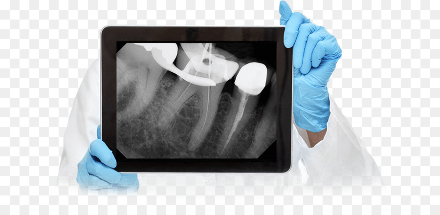 Radiografía Dental，Dientes PNG