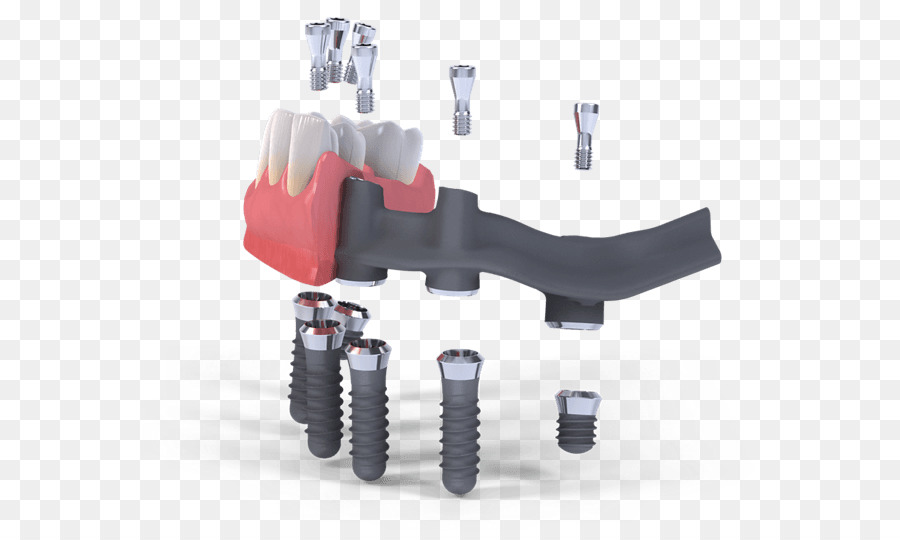 Implante Dental，Straumann PNG