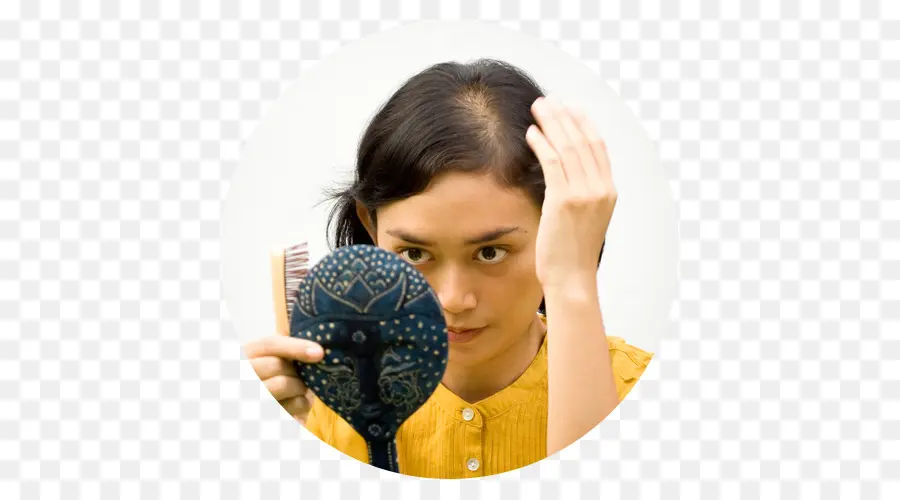 La Pérdida De Cabello，Loción PNG