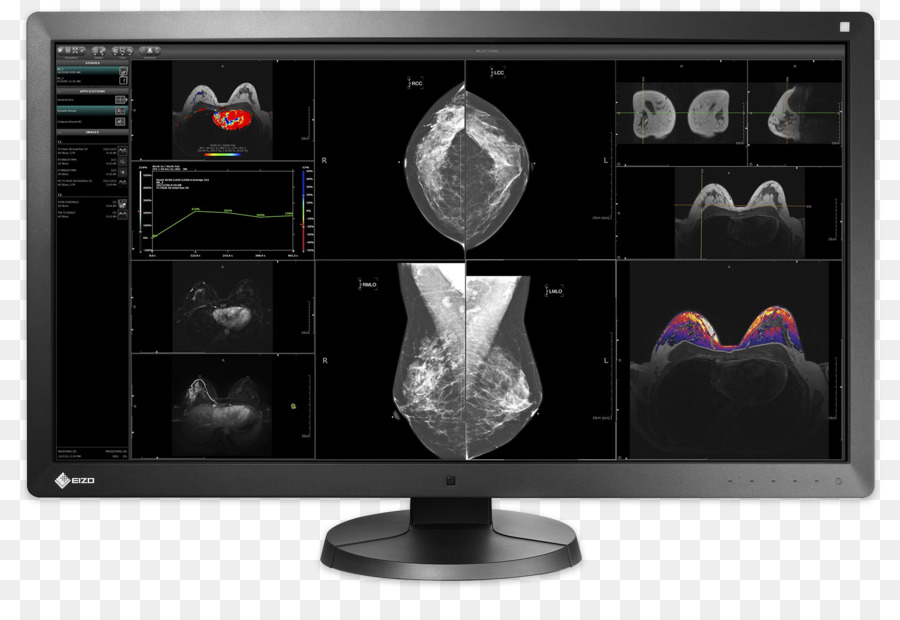 Eizo Radiforce Rx850，Eizo PNG