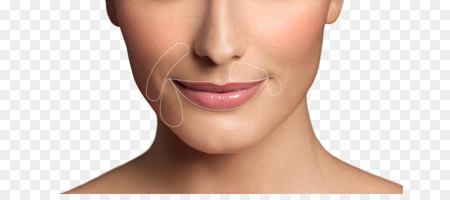 Labio，Restylane PNG