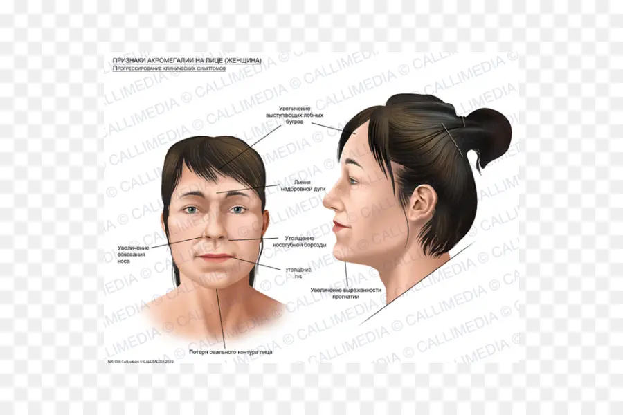 Diagrama De Rasgos Faciales，Rostro PNG