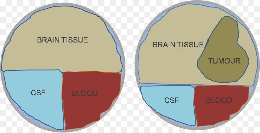 Doktryna Monrokelliego，Cerebro PNG