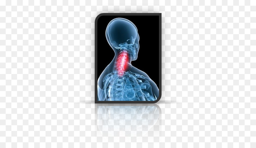 Dolor De Cuello，Cuello PNG