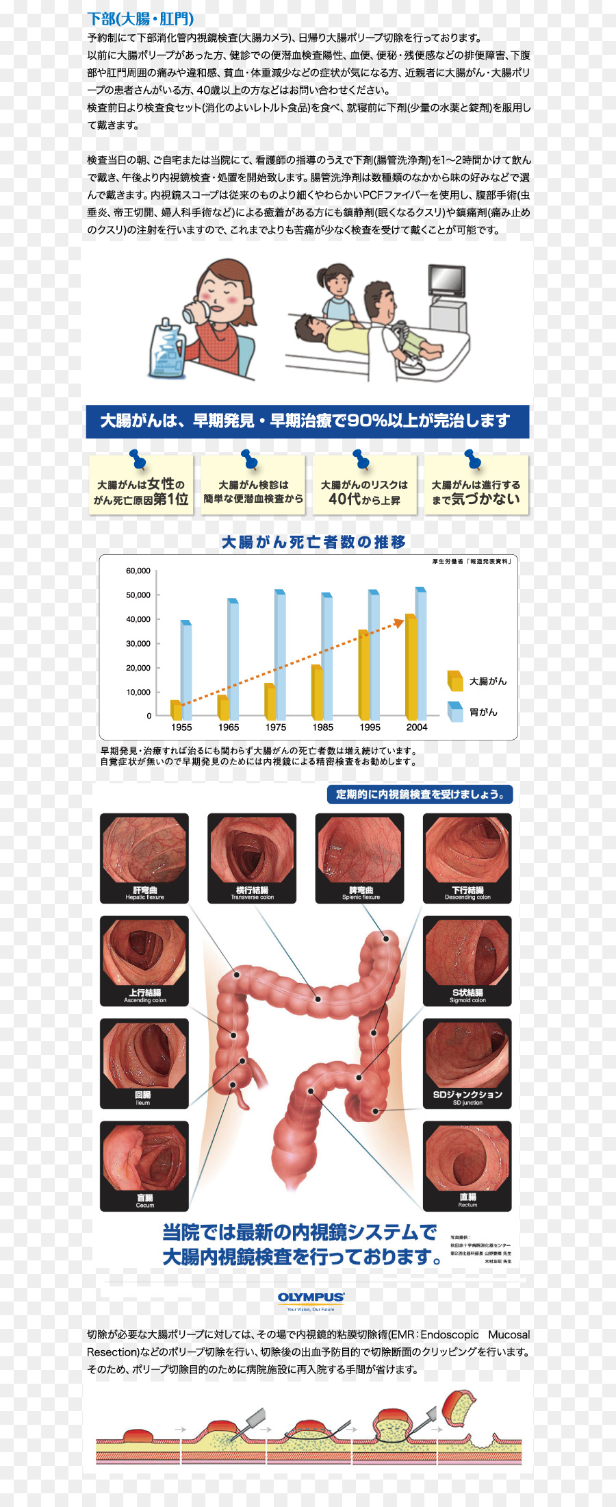 Chigasaki，La Endoscopia PNG