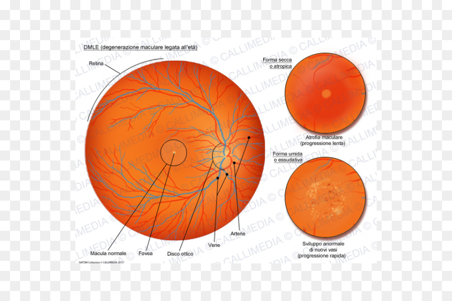 La Degeneración Macular，Mácula De La Retina PNG