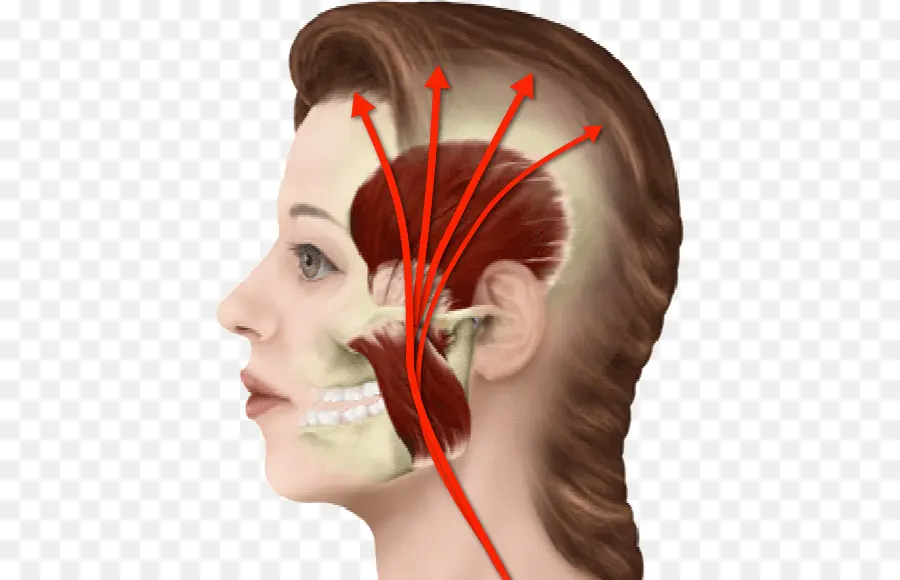 Síndrome De Dolor Miofascial，El Dolor De Cuello PNG