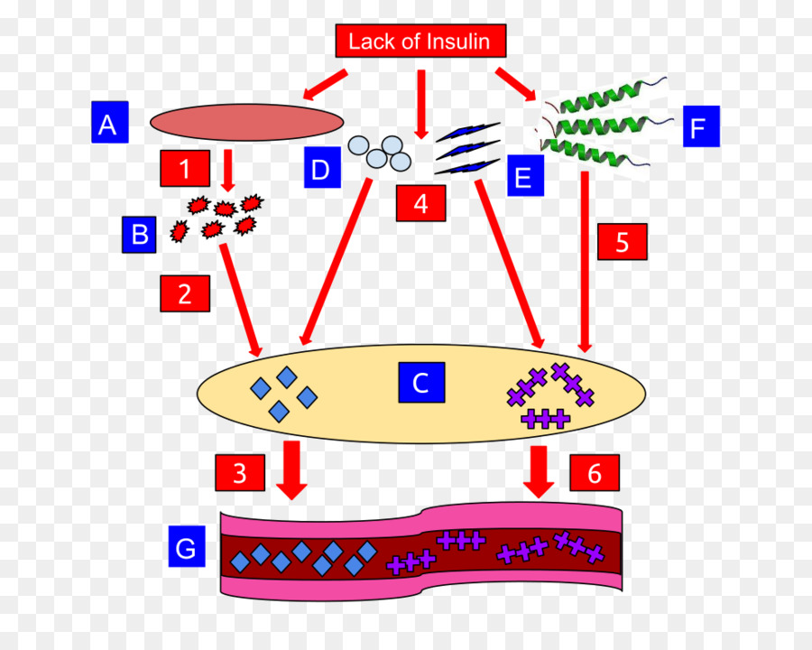 La Cetoacidosis Diabética，La Cetoacidosis PNG