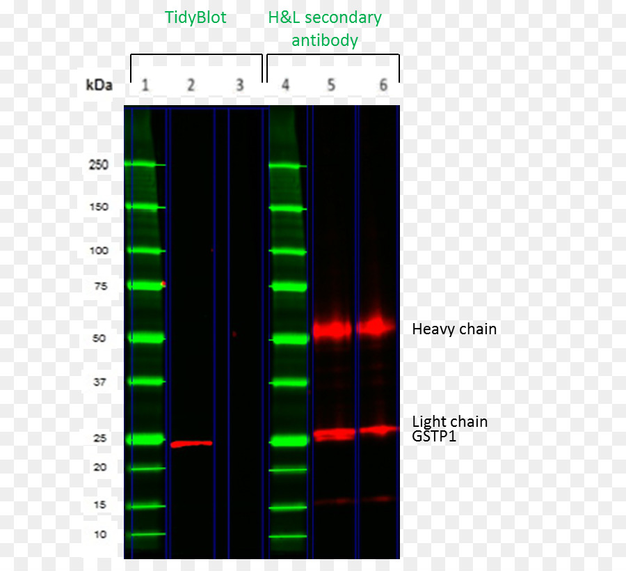 La Inmunoglobulina G，Western Blot PNG