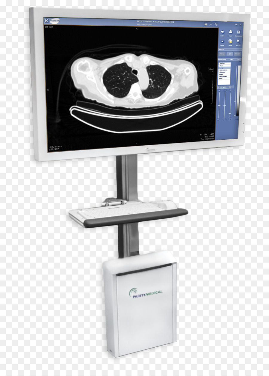 Medicina，Picture Archiving And Communication System PNG