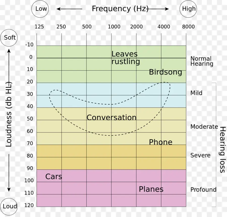 Tabla De Pérdida Auditiva，Frecuencia PNG